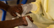 africana.news-Mpox and the Dangers of Treating Some Lives as Disposable