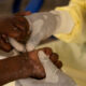 africana.news-Mpox and the Dangers of Treating Some Lives as Disposable