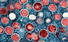 WHO Declares Mpox No Longer a Global Health Emergency